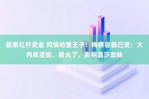 股票杠杆资金 同情哈里王子！梅根容貌已变：大肉鼻坚挺，脸尖了，影响温莎血脉